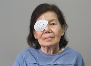 Đục thủy tinh thể ở người tiểu đường