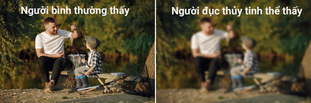 bệnh lý về mắt do bệnh tiểu đường