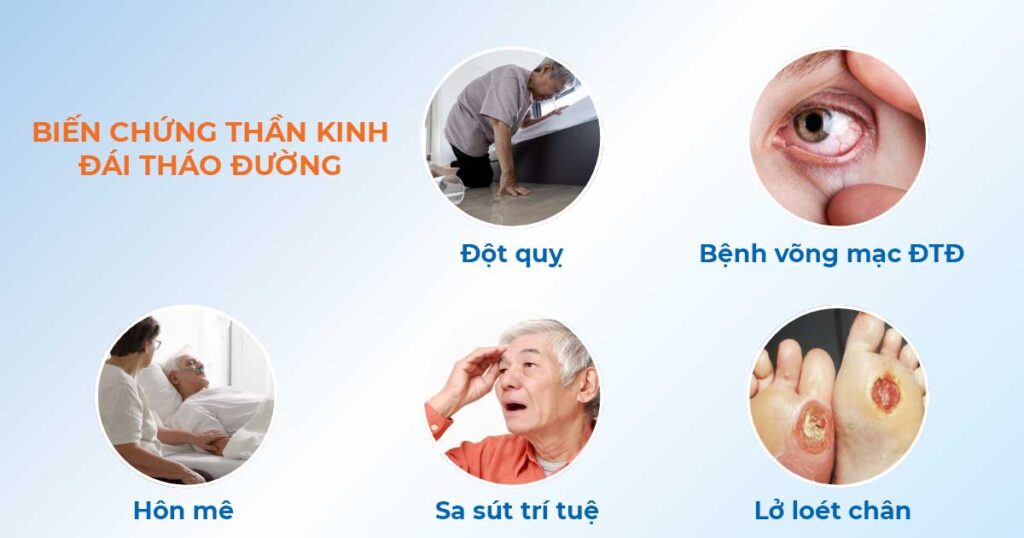 Livestream cách ổn định đướng huyết, giảm biến chứng đái tháo đường